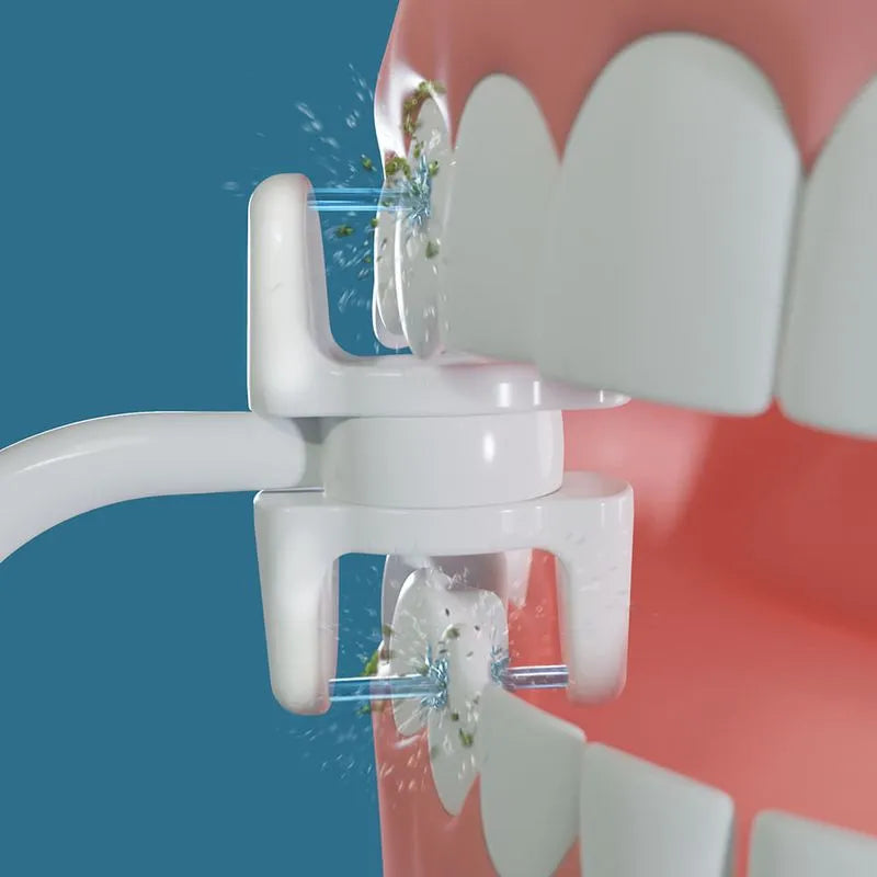Miracle Smile Irrigador Dental 1 Und.