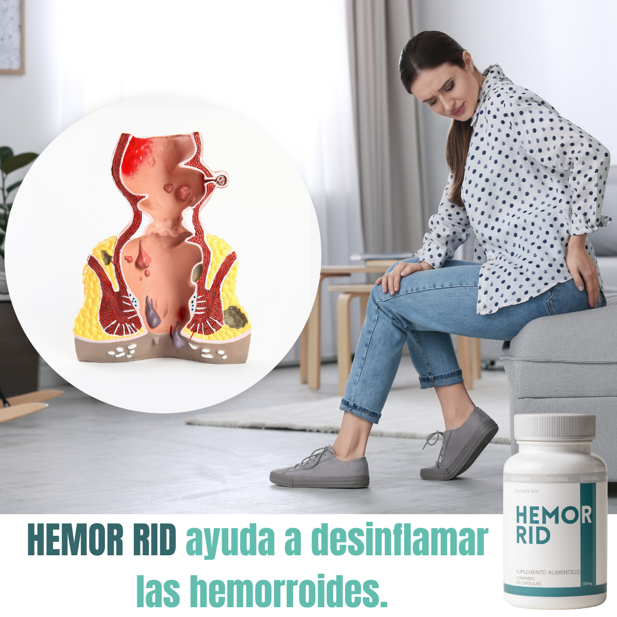 Pack X2 Kumara Hemorrid Alivio Rápido de Hemorroides 500mg