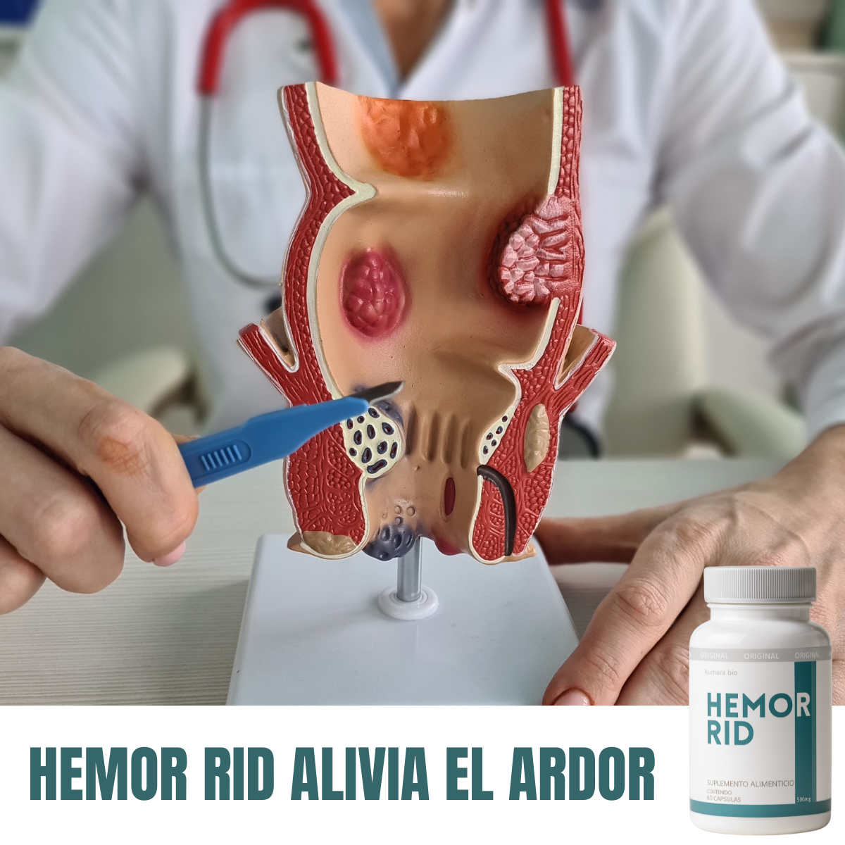 Pack X2 Kumara Hemorrid Alivio Rápido de Hemorroides 500mg