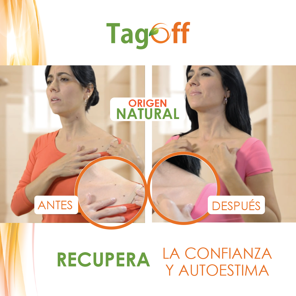 Tag Off Solución Verrugas y Carnosidades 15 ml 1 Und.