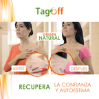 Tag Off Solución Verrugas y Carnosidades 15 ml 1 Und.