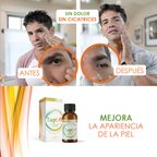 Tag Off Solución Verrugas y Carnosidades 15 ml 1 Und.