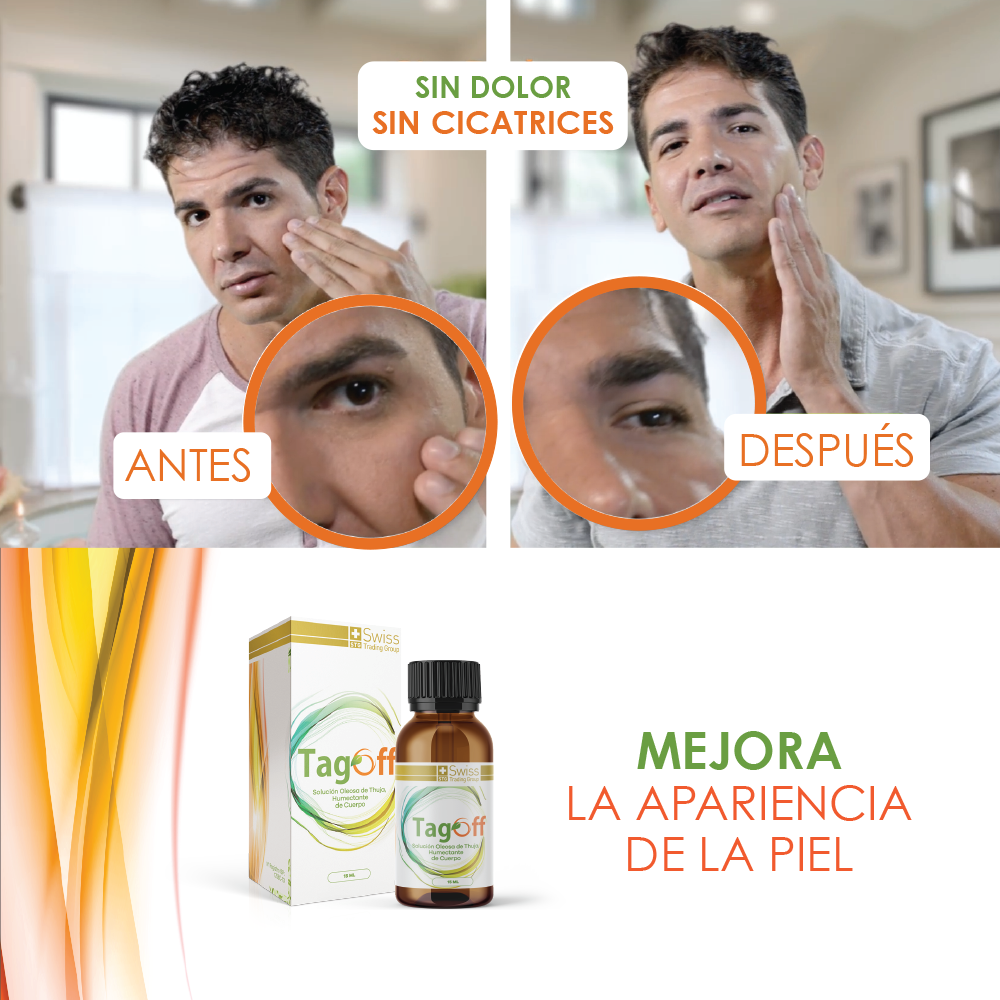 Tag Off Solución Verrugas y Carnosidades 15 ml 1 Und.