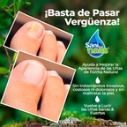 Sani Nails Ayuda a combatir los hongos de las uñas 30ml