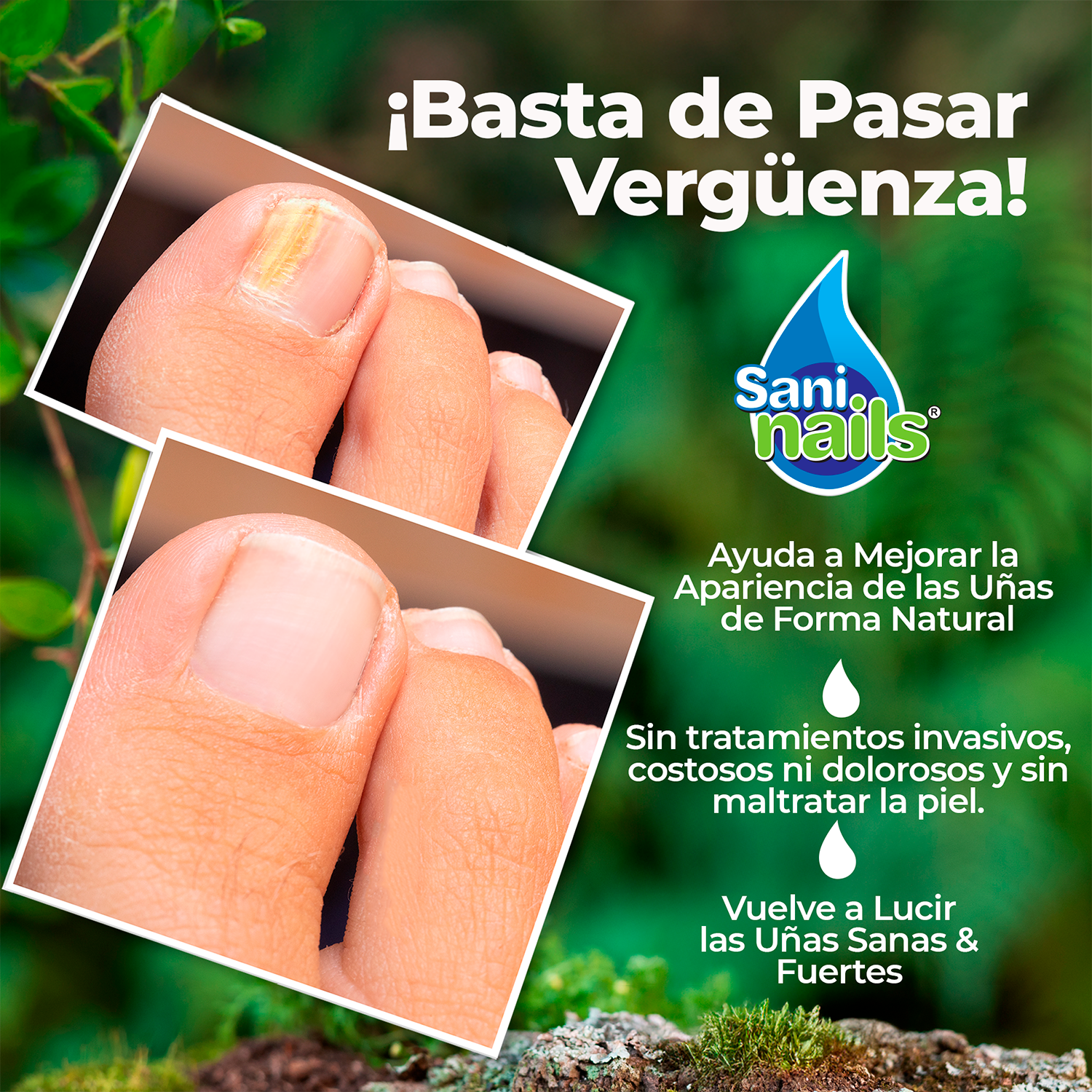 Sani Nails Ayuda a combatir los hongos de las uñas 30ml