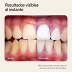 Lumea Blanqueador Dental 60ml