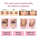 Masajeador Limpieza Facial Ultrasónico