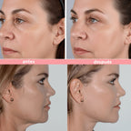 Masajeador Facial Microcorriente USB contra Arrugas y Reafirmante Facial