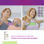 Tabs Off Elimina Verrugas 15ml